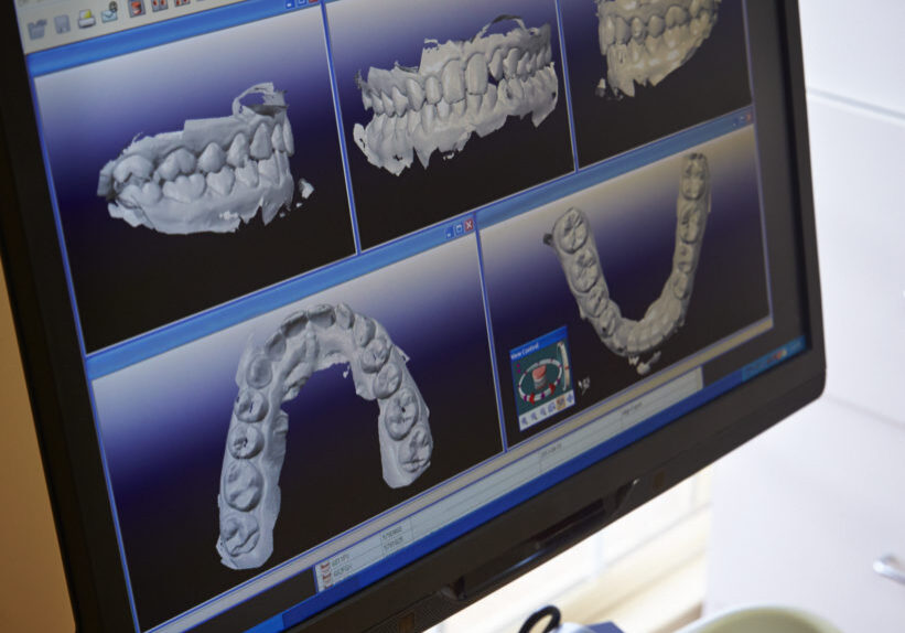 3D Dental Computer